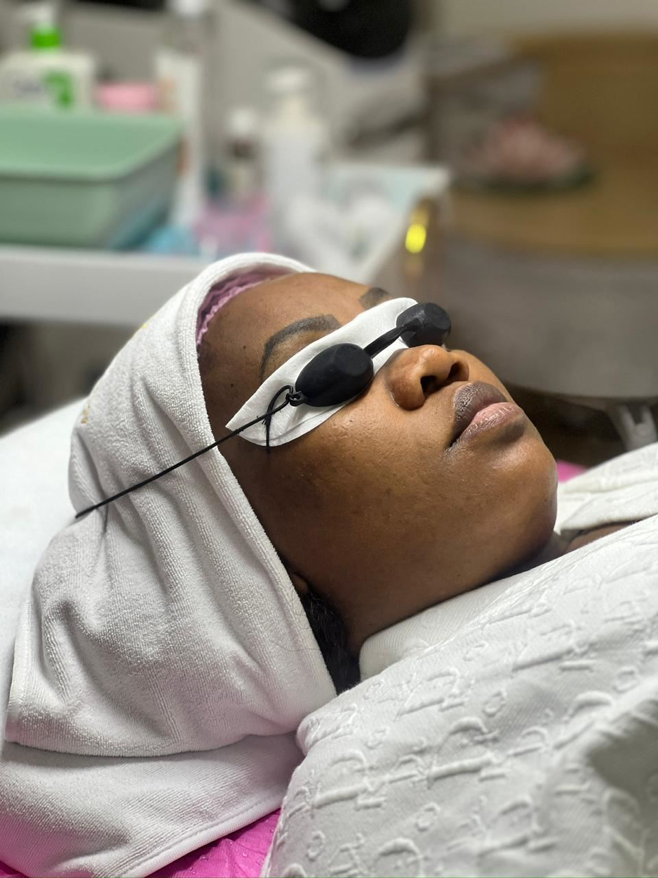 A client wearing eye shields for a laser treatment